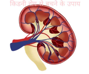 किडनी रोग से बचने के उपाय |Kidney ko healthy kaise rakhe|in hindi