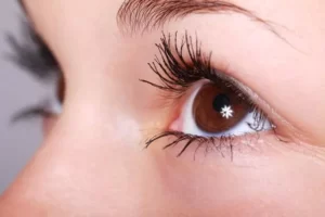 आँखो में खुजली और सूजन का इलाज | Itchy eyes home remedies | in hindi
