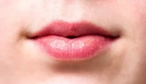 Dark and dry lips treatment in hindi