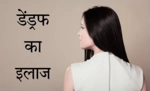 dandruff treatment in hindi