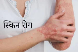 Skin problems in hindi