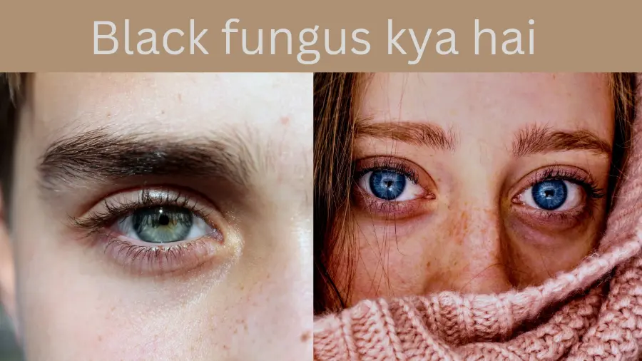 Black fungus symptoms