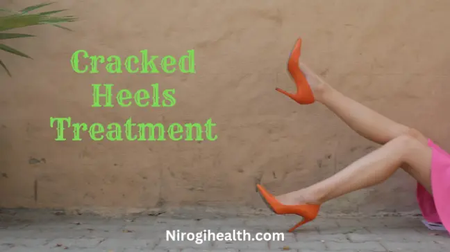 Crack heel care tips in hindi